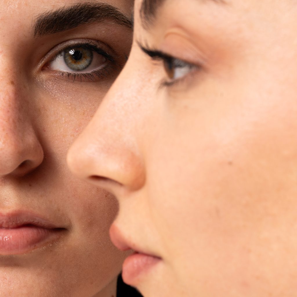 Skincare per Pelle Secca con Imperfezioni: la Guida Completa